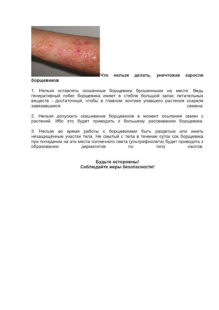 Памятка по борьбе с борщевиком Сосновского